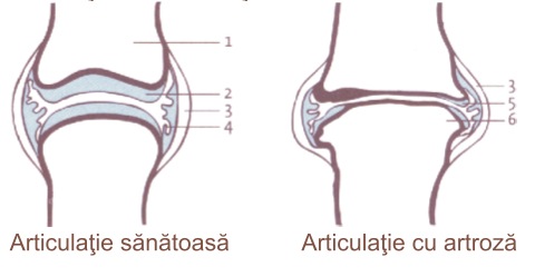 traumeel în tratamentul artrozei dureri rare la genunchi